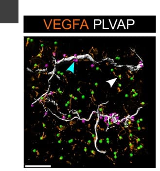 Open access visualization of Microscopy, Volumetric Reconstruction, PLVAP Blood Vessels, VEGFA Cells, Blood Vessels