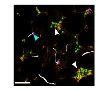 Open access visualization of Microscopy, Obese Mice, VEGFA Cells, Blood Vessels