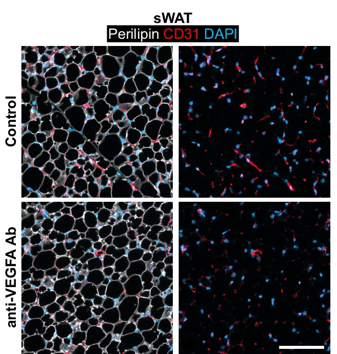 Open access visualization of Microscopy, Confocal Images, CD31 Blood Vessels, Perilipin Adipocyte, DAPI Nuclei