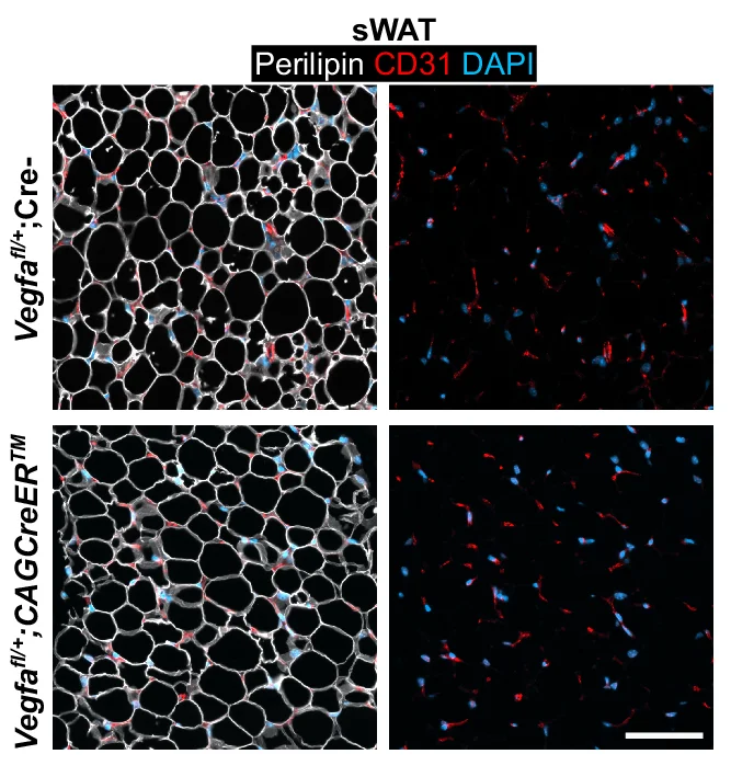 Open access visualization of Microscopy, Quantification, PLVAP, Blood Vessel, Isolectin B4
