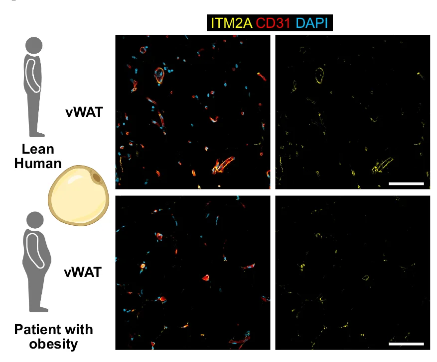 Open access visualization of Microscopy, Illustration, Graphical Summary, Obesity-Associated Vascular Alterations, Subcutaneous White Adipose Tissue