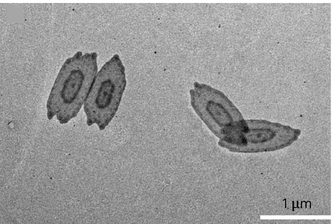 Open access visualization of Microscopy, TEM Image, Block Co-micelles, Polycaprolactone, Poly(hexyl lactide)