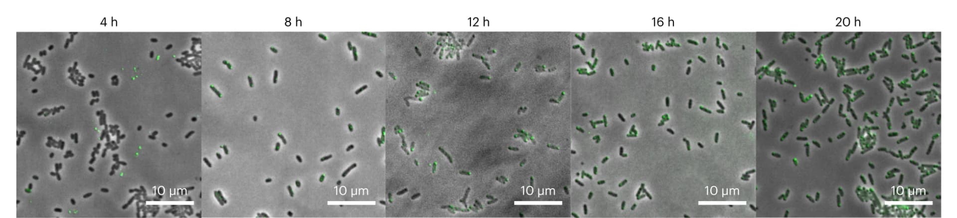 Open access visualization of Microscopy, Photo, Fluorescence micrographs, Cells, Protein expression
