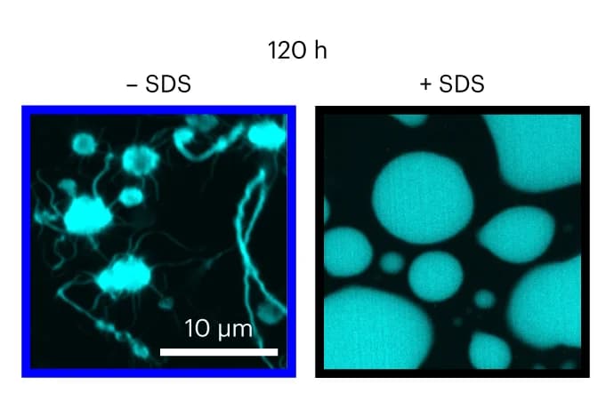 Open access visualization of Microscopy, SDS, B-LCD, ThT-positive rims, star-shaped aggregates