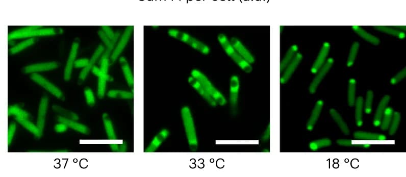Open access visualization of Microscopy, Live-Cell Confocal Microscopy, HERD-2.2-GFP, E. coli, Inclusion Bodies