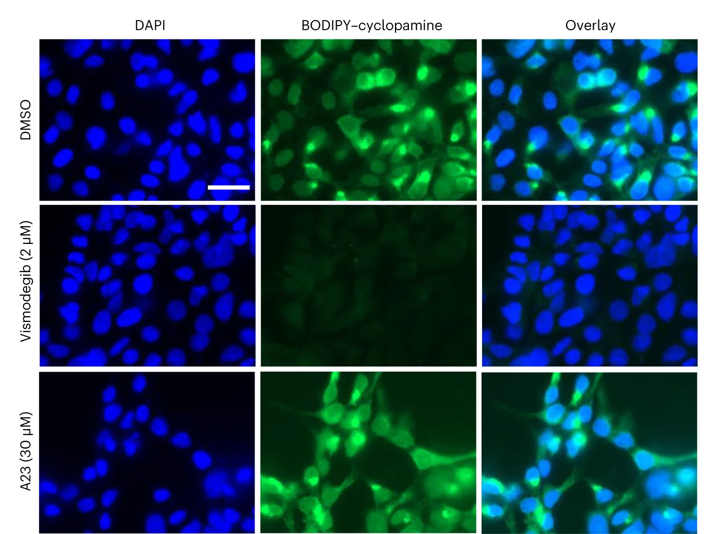 Open access visualization of Microscopy, SMO Binding Assay, HEK293T Cells, SMO-expressing Plasmid, BODIPY-cyclopamine