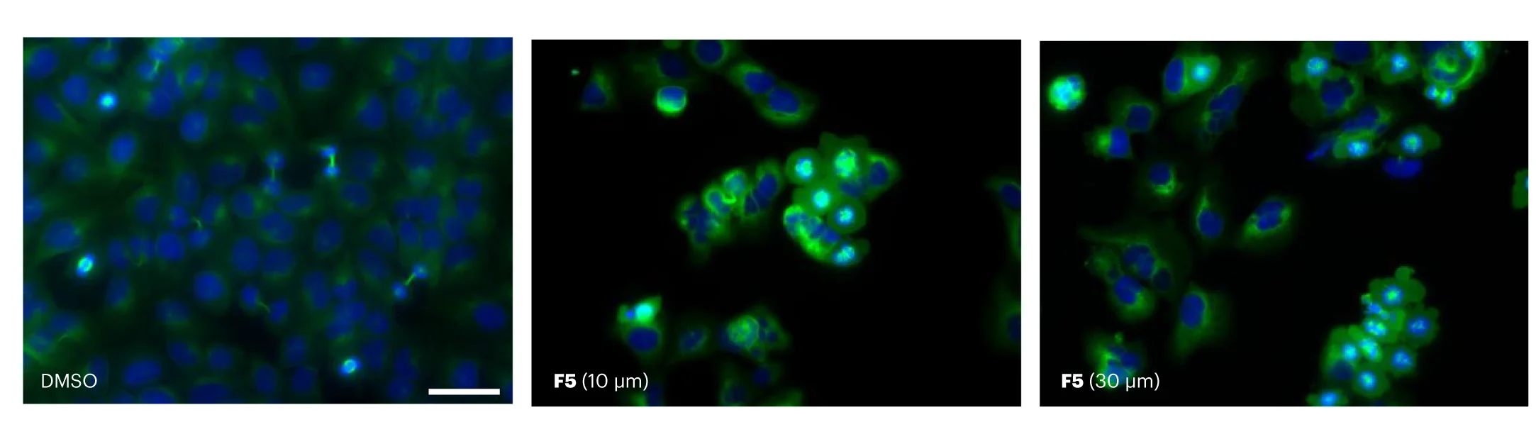 Open access visualization of Microscopy, Microtubule Network, U2OS Cells, DMSO, Tubulin
