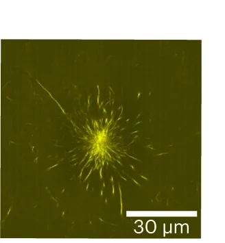 Open access visualization of Microscopy, Confocal Microscopy, Amyloid Starburst, ThT Fluorescence, Amyloid Aggregation