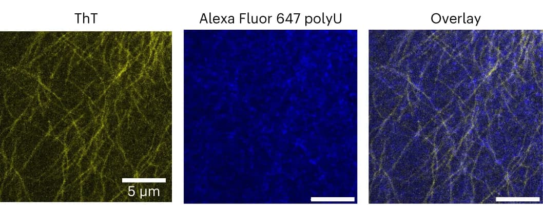 Open access visualization of Microscopy, Confocal Microscopy, Fluorescence Microscopy, hnRNPA1A Fibrils, polyU