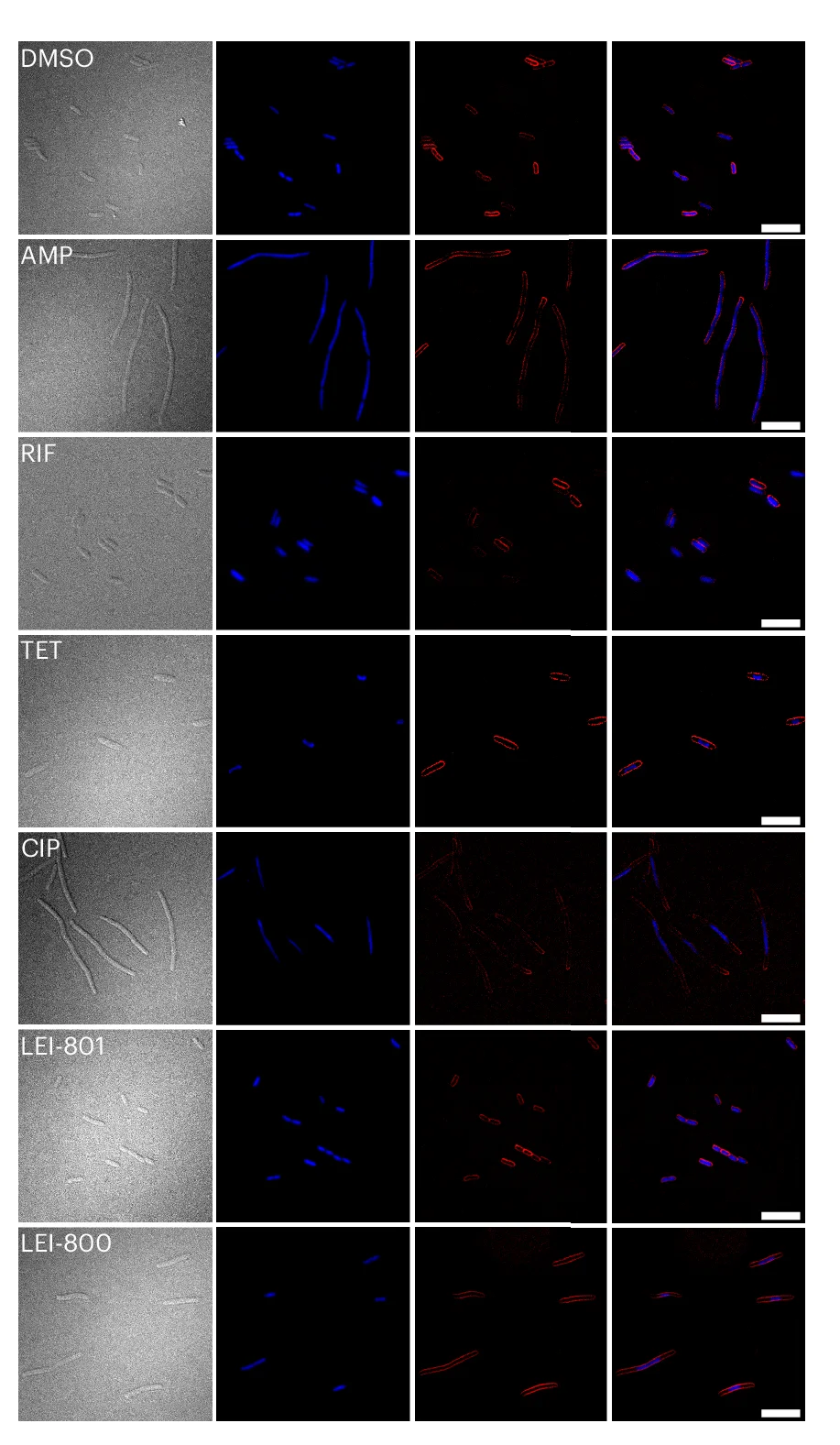 Open access visualization of Microscopy, Microscopy Images, E. Coli, BCP Experiment, DIC