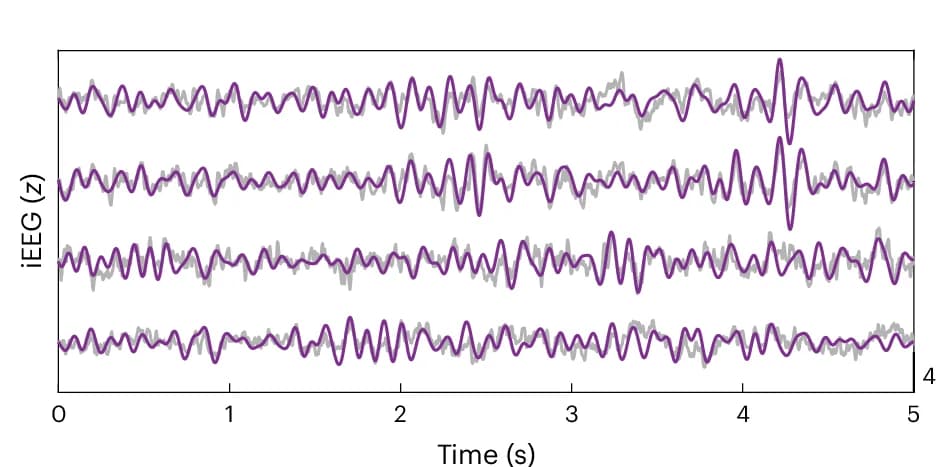 Open access visualization of Line Plot, iEEG, Real-world Navigation, Imagined Navigation, Theta Band