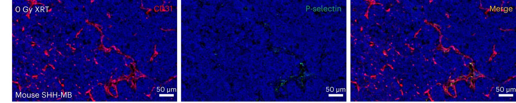 Open access visualization of Microscopy, Immunofluorescence, P-selectin, Vasculature, CD31