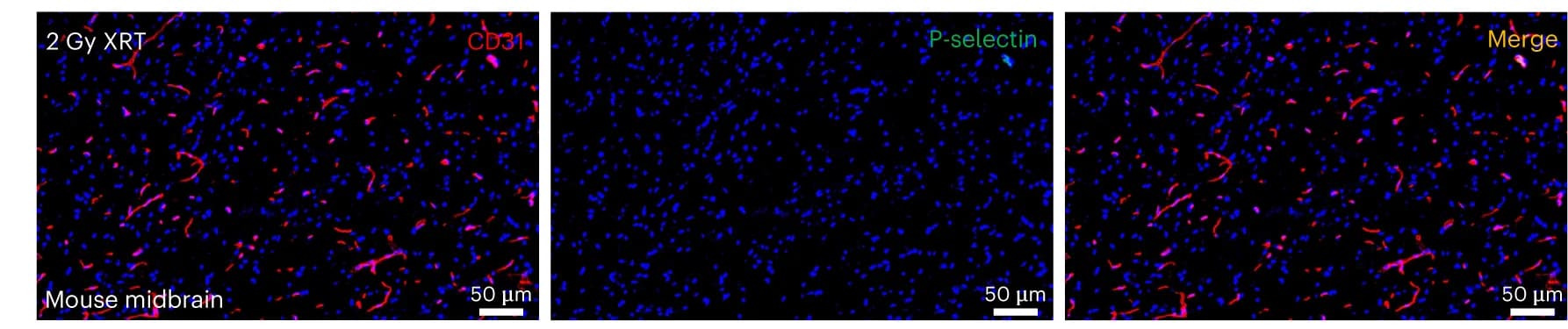 Open access visualization of Microscopy, Immunofluorescence, Non-Tumor Tissue, Midbrain, Whole-body-irradiated Mice