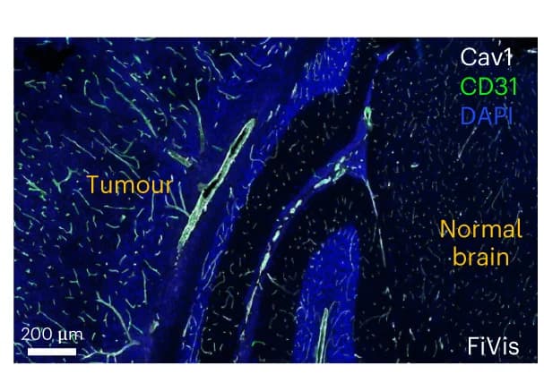 Open access visualization of Microscopy, Immunofluorescence, Cav1, CD31, SHH-MB Mouse Tumors