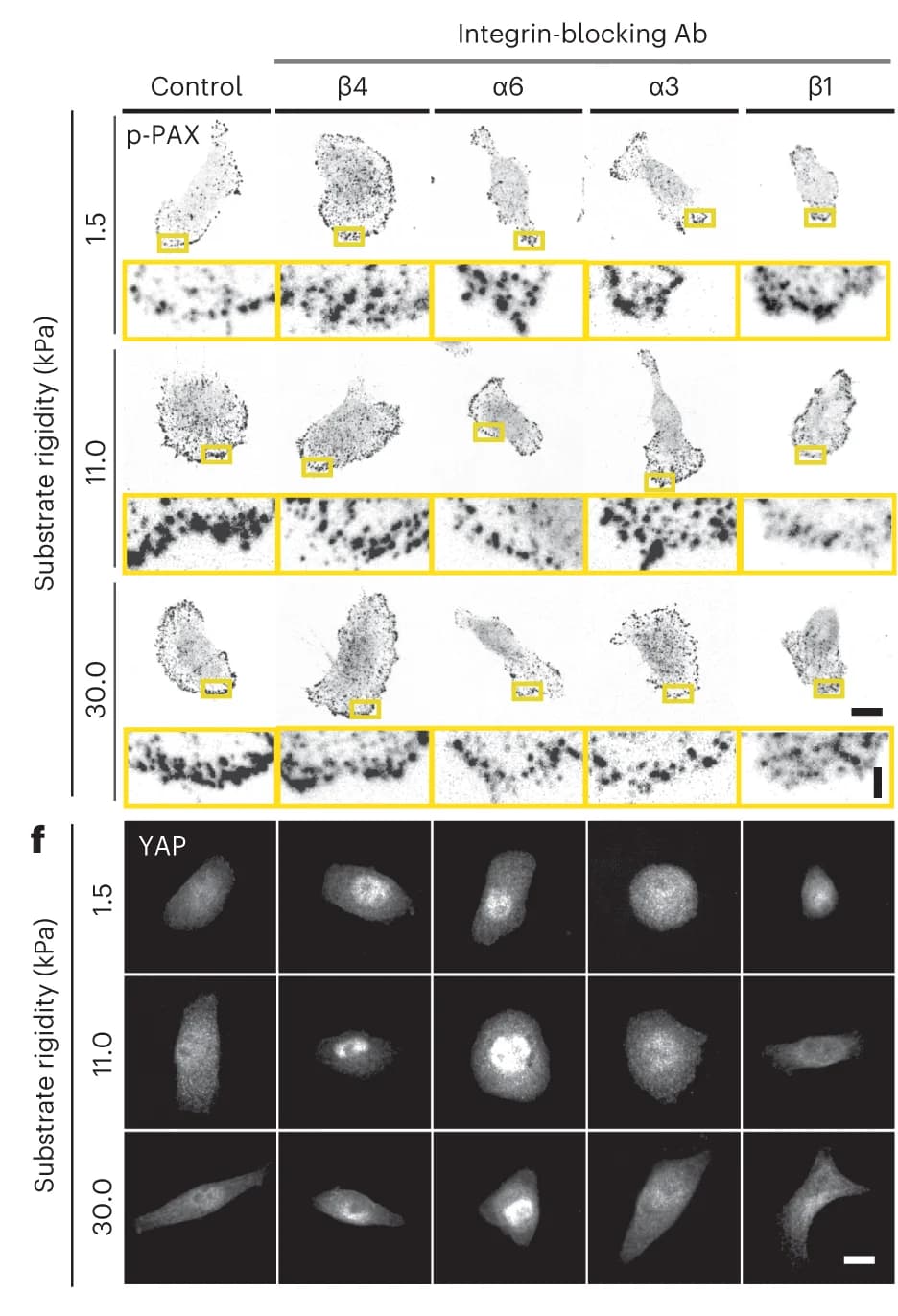 Open access visualization of Microscopy, Photo, MCF10A Cells, p-Pax Staining, Integrin-blocking Antibodies