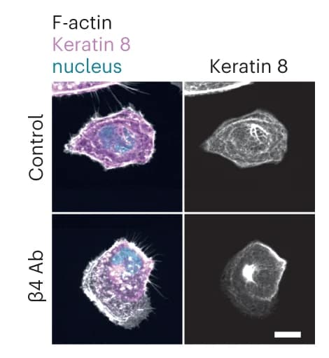 Open access visualization of Microscopy, Actin, Keratin 8, MCF10A Cells, PAA Gels