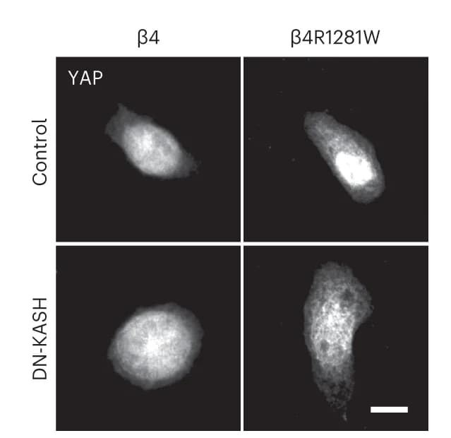 Open access visualization of Microscopy, Control Cells, DN-KASH, YAP, Laminin