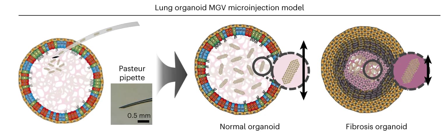Open access visualization of Illustration, Microinjection, Lung Organoid, Stiffness Change, MGVs