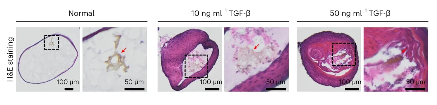 Open access visualization of Microscopy, H&E Staining, Organoid Sections, Fibrosis, MGVs