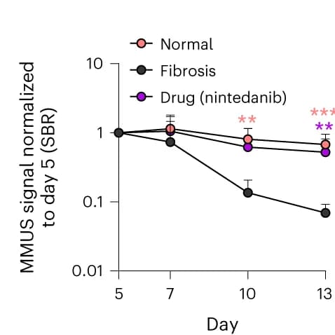Open access visualization of Line Plot, Error Bars, SBR Quantification, Lung Organoids, Fibrosis