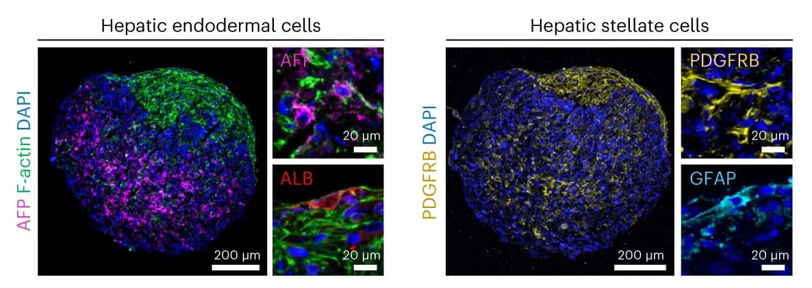 Open access visualization of Microscopy, Immunofluorescence, Hepatic Endodermal Cells, Hepatic Stellate Cells, Liver Organoids