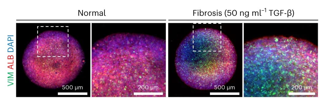 Open access visualization of Microscopy, Immunofluorescence, Fibrotic Marker, Hepatic Marker, Liver Organoids