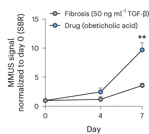 Open access visualization of Line Plot, Error Bars, SBR Quantification, MGV, Liver Organoids