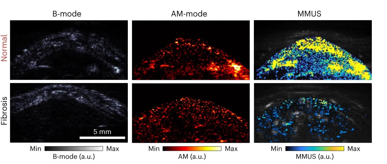 Open access visualization of Microscopy, Ultrasound Images, SBR Quantification, Normal Cohort, Fibrosis Cohort