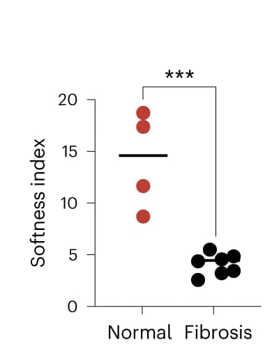 Open access visualization of Scatter Plot, Ultrasound Images, SBR Quantification, Normal Cohort, Fibrosis Cohort