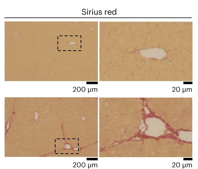 Open access visualization of Microscopy, Sirius Red Staining, Histology, Low Magnification, High Magnification