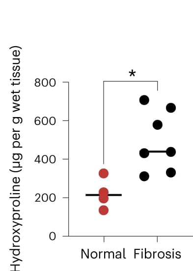 Open access visualization of Scatter Plot, Hydroxyproline Content, Liver, Normal Group, Fibrosis Group