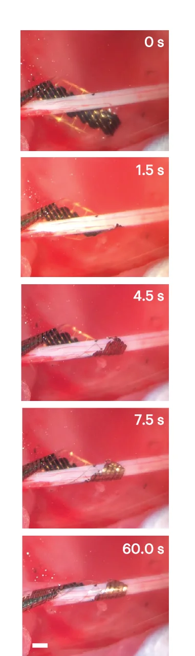 Open access visualization of Microscopy, Photo, Nerve Cuff, Sciatic Nerve, Voltage
