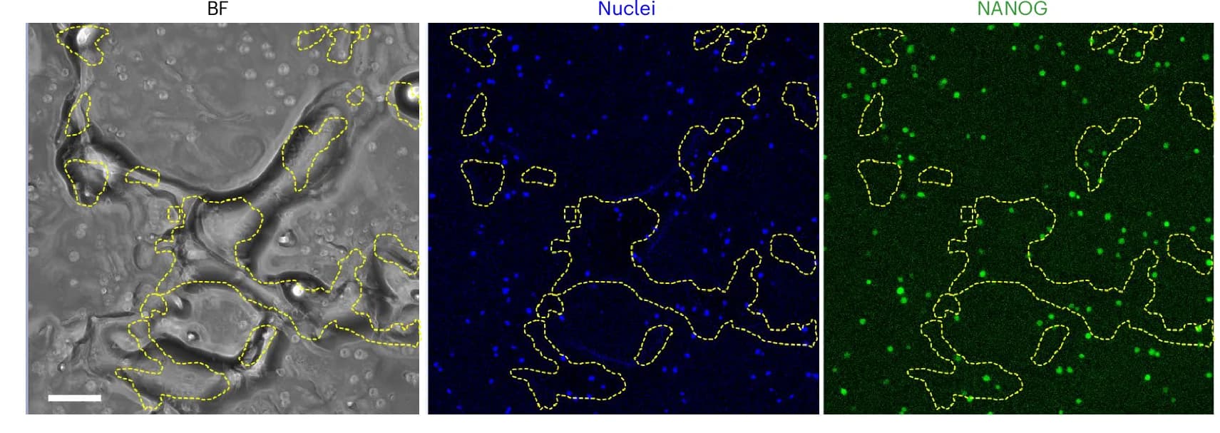 Open access visualization of Microscopy, Bright-Field, Nuclei, NANOG Staining, Cell-BMS Interaction