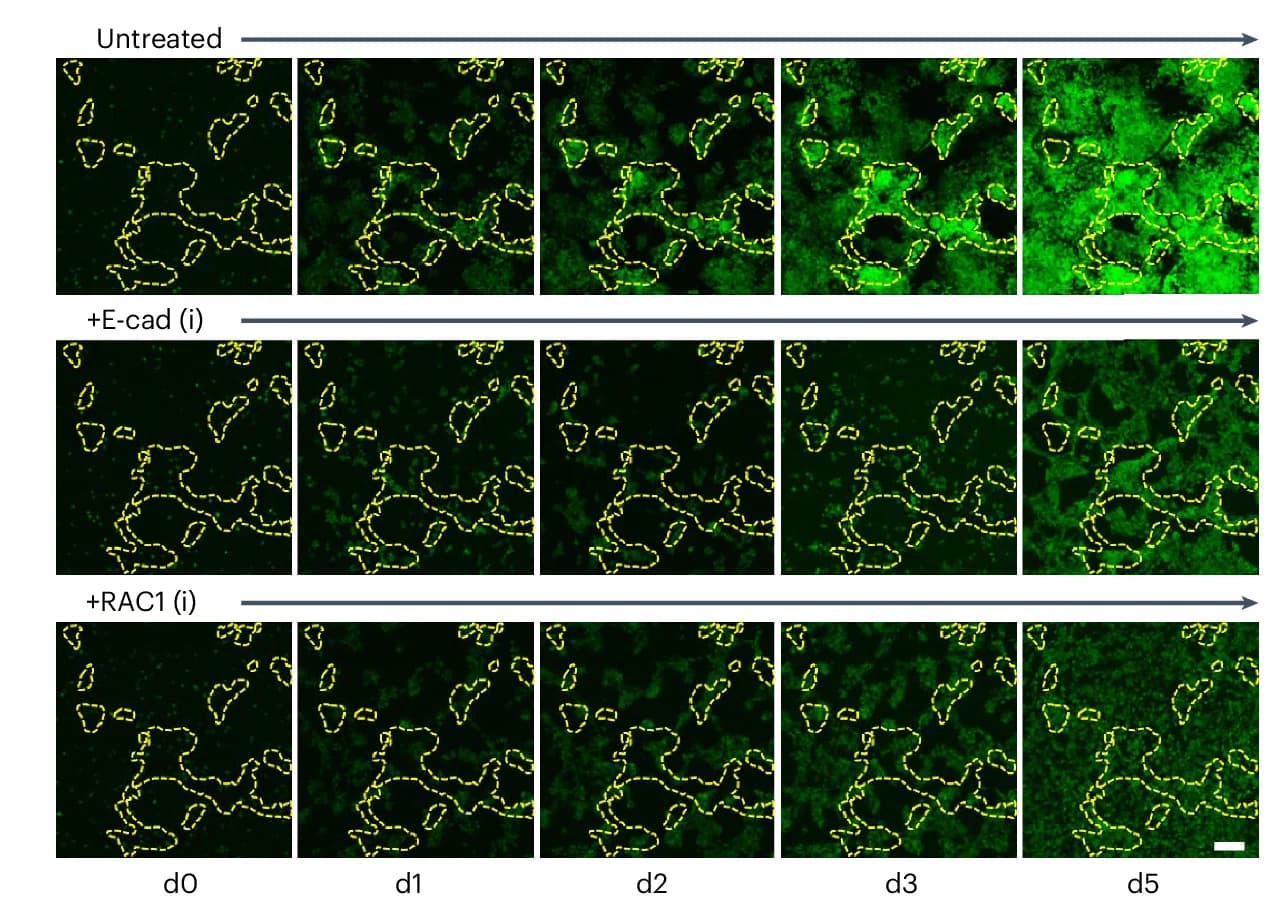 Open access visualization of Microscopy, Dynamic Changes, NANOG-GFP, PSC, BMS