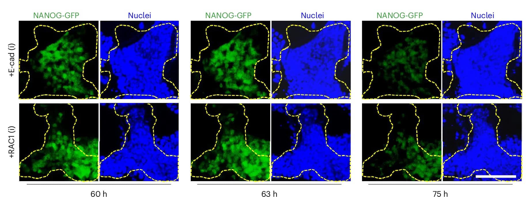 Open access visualization of Microscopy, Time-Lapse Images, E-cad Inhibition, RAC1 Inhibition, PSC