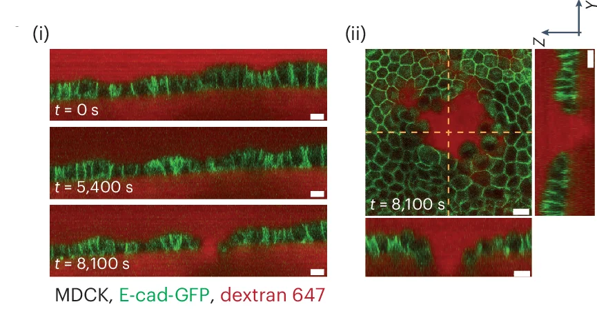 Open access visualization of Microscopy, Confocal Images, Monolayer Profile, Calyculin Treatment, Intercellular Junctions