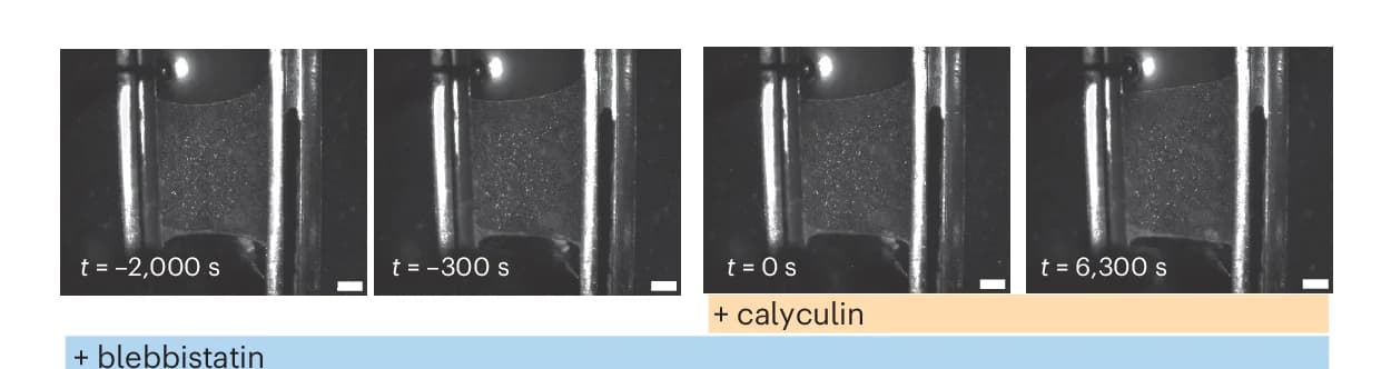 Open access visualization of Microscopy, Photo, Bright-Field Microscopy, Monolayer, Blebbistatin