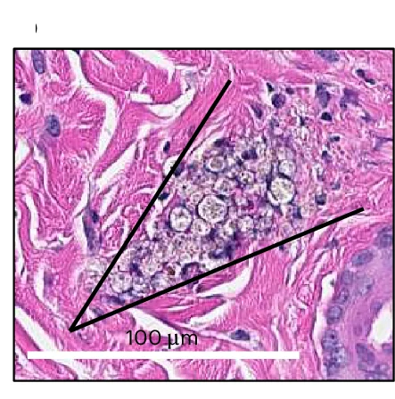 Open access visualization of Microscopy, QD–PMMA Microparticles, Dermis, In Vivo, Yorkshire Pigs