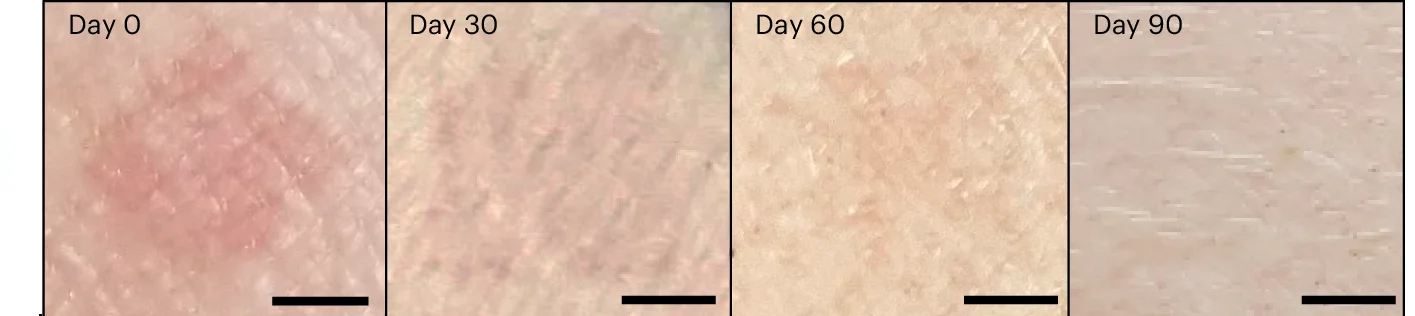 Open access visualization of Photo, OPMR Dyes, Pig Skin, Scale Bars