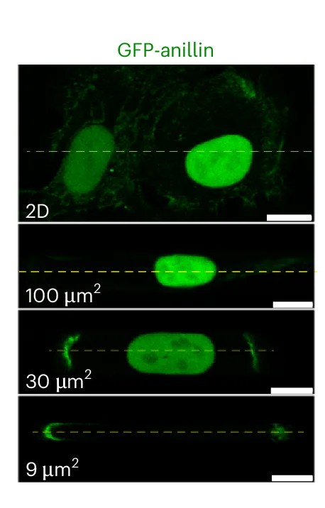 Open access visualization of Microscopy, Live Cell Images, GFP-anillin Intensity, ACE Frequency, HT-1080 Cells