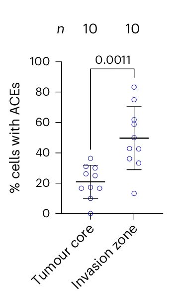 Open access visualization of Scatter Plot, Error Bars, ACEs, Invasion Zone, Tumour Core
