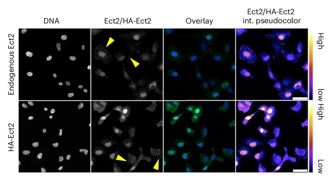 Open access visualization of Microscopy, HT-1080 Cells, 2D Substrates, Ect2, Cell Nucleus