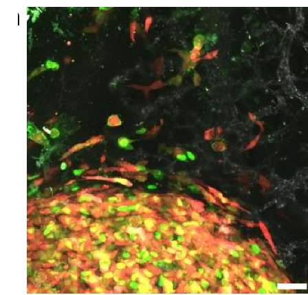 Open access visualization of Microscopy, mCherry-tagged HT-1080 Cells, GFP-anillin, HA-Ect2, Tumour
