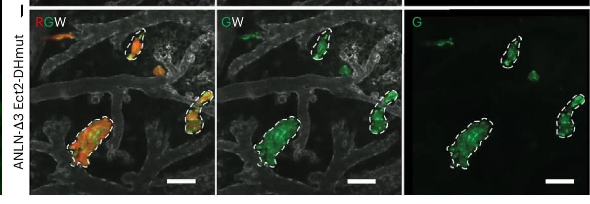 Open access visualization of Microscopy, Metastatic Lesions, GFP-anillin-3, HA-Ect2-DHmut
