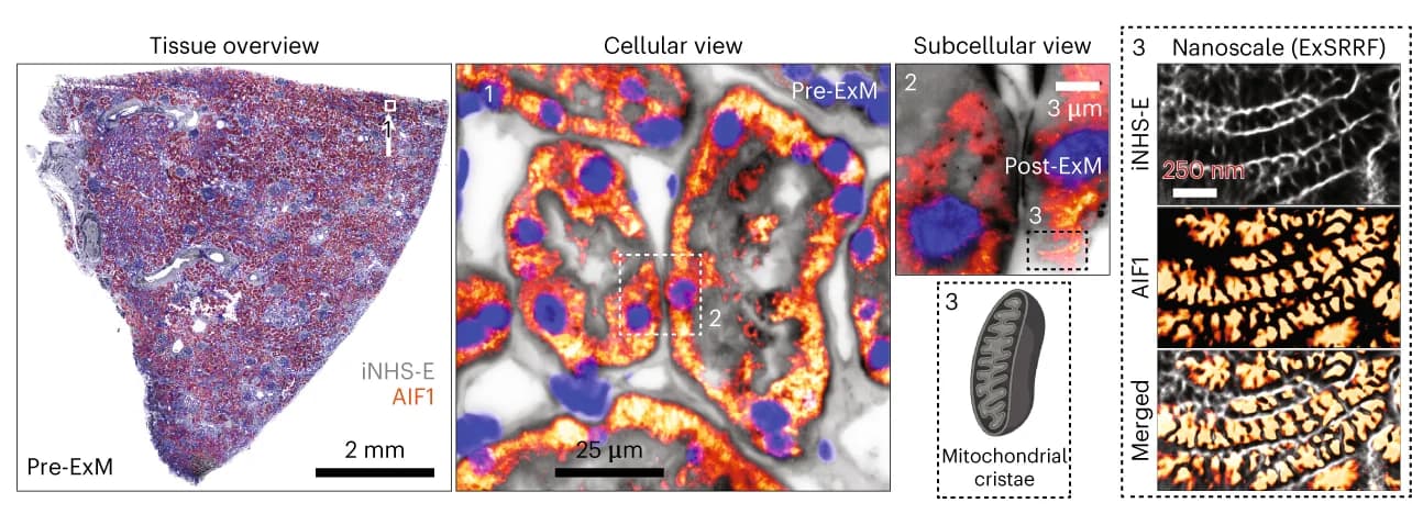 Open access visualization of Microscopy, Illustration, Kidney Sample, Pan-protein staining, Mitochondrial marker