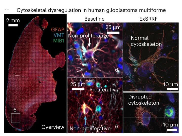 Open access visualization of Microscopy, ExSRRF, Cell heterogeneity, Human glioblastoma, Cell Proliferation
