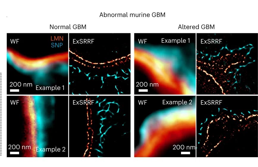 Open access visualization of Microscopy, Glomerular basement membrane, Laminin, Podocytes, Synaptopodin