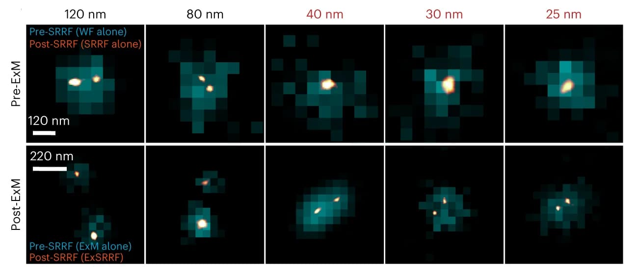 Open access visualization of Microscopy, Wide-field Microscopy, Super-Resolution Radial Fluctuations, Expansion Microscopy, Expansion Super-Resolution Radial Fluctuations
