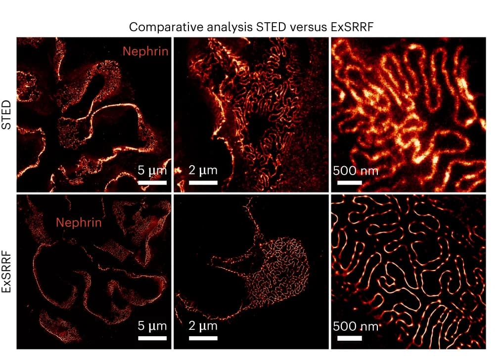 Open access visualization of Microscopy, Stimulated Emission Depletion Microscopy, Expansion Super-Resolution Radial Fluctuations, Kidney, Nephrin
