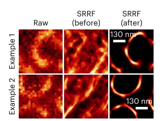 Open access visualization of Microscopy, Super-Resolution Radial Fluctuations, Drift artifacts, Realignment
